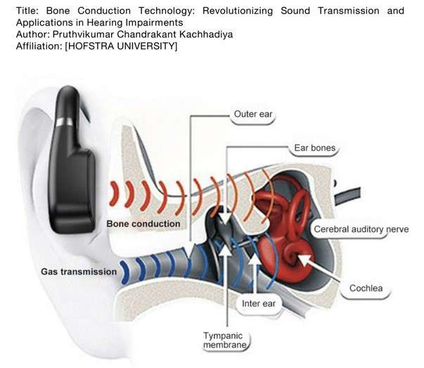 Bone Conduction Technology